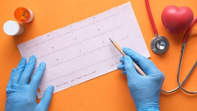 心電図を分析する医療従事者