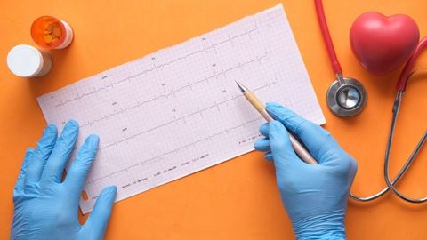 Professionnel de santé analysant un électrocardiogramme