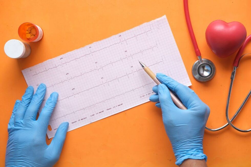 Profesional sanitario analizando un electrocardiograma